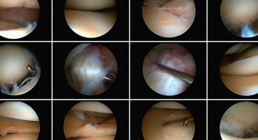 Minimal invasive Gelenkchirurgie, Arthroskopische Operationen - Dr. Alexander Zembsch - Orthopäde Wien 1130