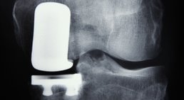 Dr. Christian Klein - Orthopäde Mondsee 5310