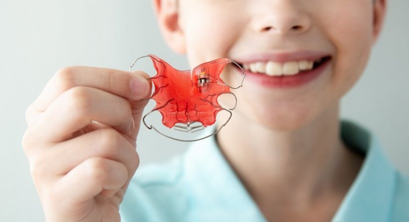 Abnehmbare Zahnspangen - Dr. Sabine Nahler - Zahnärztin Wien 1010