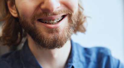 Zahnspangen für Erwachsene