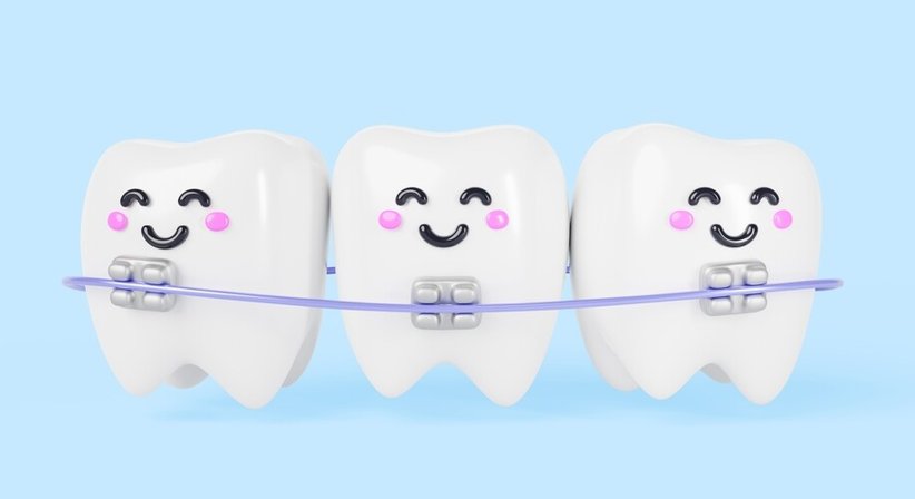 Zahnspangen für Kinder & Jugendliche - Dr. Sabine Nahler - Zahnärztin Wien 1010