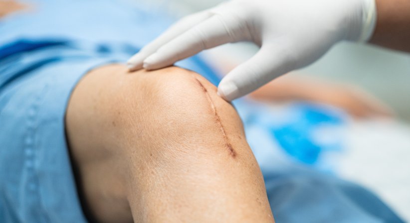 Kniechirurgie - Dr. Michael Pittermann - Orthopäde Wien 1060