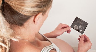 Pränatale Beratung und Diagnostik