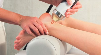 Extrakorporale Stoßwellentherapie (ESWT)