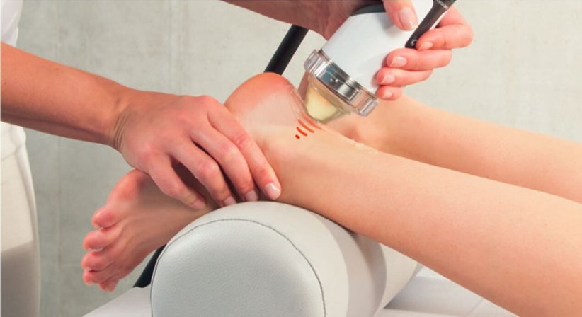 Extrakorporale Stoßwellentherapie (ESWT) - Dr. Michael Messenbäck - Orthopäde Böheimkirchen 3071