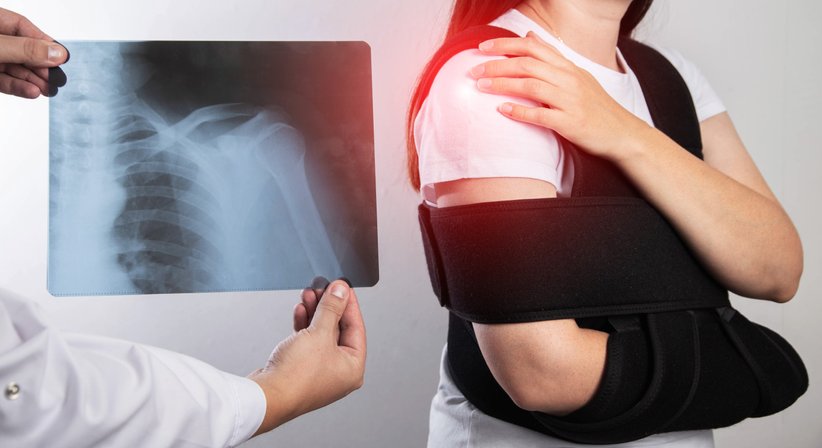 Arthroskopische Schulterchirurgie - OA Dr. med. Albert Zich - Orthopäde Wien 1180