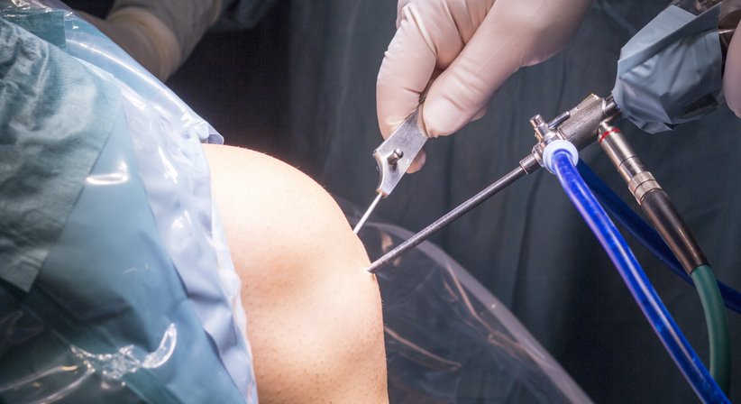 Arthroskopische Kniechirurgie - OA Dr. med. Albert Zich - Orthopäde Wien 1180