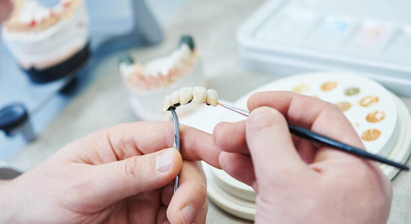 Zahnersatz/ Prothetik - Dr. Lucas Nahler - Zahnarzt Wien 1010