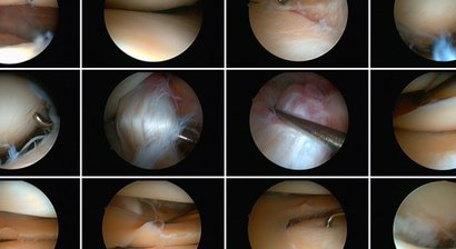 Arthroskopie (Sprunggelenk, Knie)