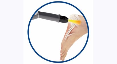 ESWT Stosswellentherapie