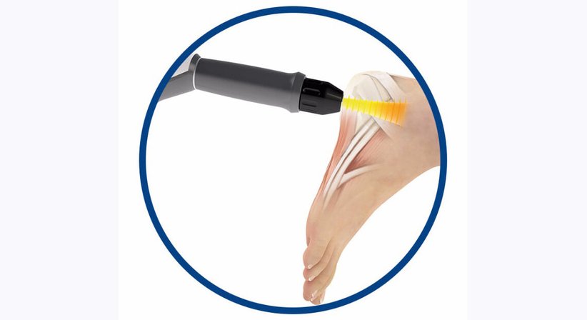 ESWT Stosswellentherapie - Dr. Julian Bayerl - Orthopäde Wien 1020