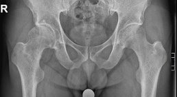 OA. Dr. Michael Rösch - Orthopäde Wien 1050