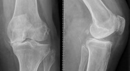 OA. Dr. Michael Rösch - Orthopäde Wien 1050