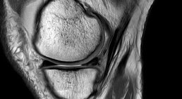 OA. Dr. Michael Rösch - Orthopäde Wien 1050