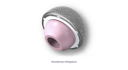 Hüftprothese/Künstliches Hüftgelenk
