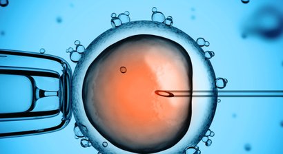 Künstliche Befruchtung