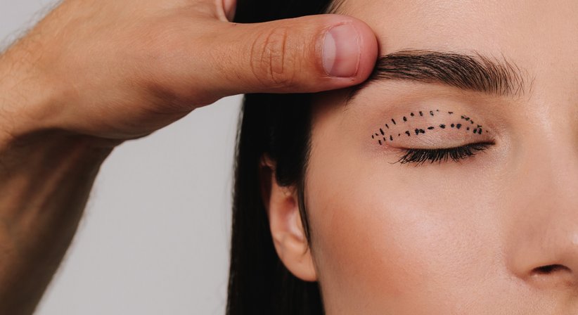 Lidoperationen - OA Dr. Ammar Alkhalde, FEBO - Augenarzt Wien 1210