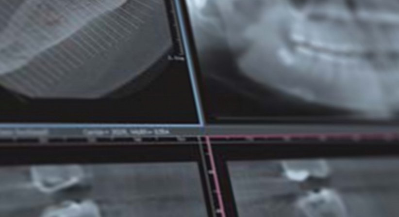 3D Röntgen - DDr. Peter Schuller-Götzburg, aHCM, MDSc MLS - Zahnarzt Salzburg 5020