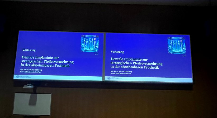 Neuversorgung bestehender Implantate - DDr. Peter Schuller-Götzburg, aHCM, MDSc MLS - Zahnarzt Salzburg 5020