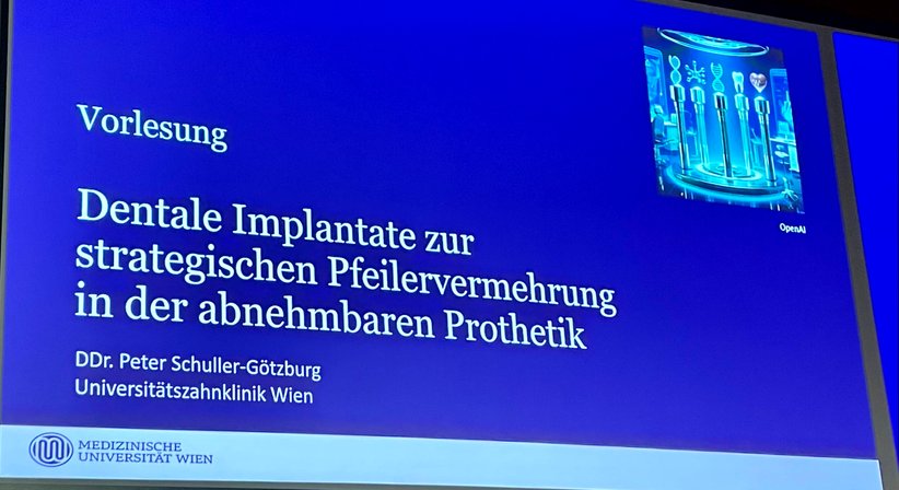 Neuversorgung bestehender Implantate - DDr. Peter Schuller-Götzburg, aHCM, MDSc MLS - Zahnarzt Salzburg 5020