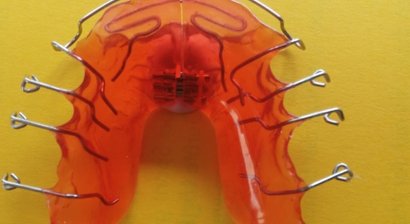 Kassenkieferorthopäde & Gratiszahnspange