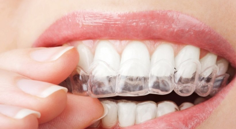 Kassenkieferorthopäde & Gratiszahnspange - DDr. Peter Schuller-Götzburg, aHCM, MDSc MLS - Zahnarzt Salzburg 5020