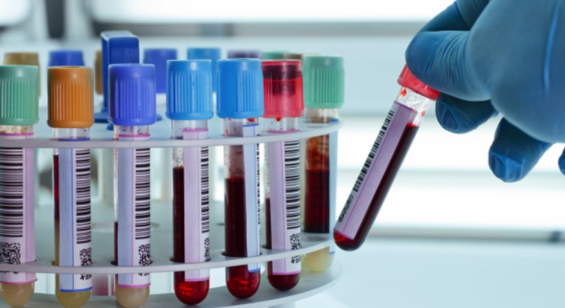 Eigenbluttherapie (PRP) - Dr. Ines Bonelli - Hautärztin Wien 1060