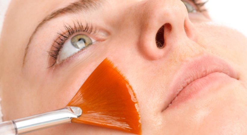 Fruchtsäurepeeling - Dr. Ines Bonelli - Hautärztin Wien 1060