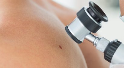 Hautkrebs - Vorsorge