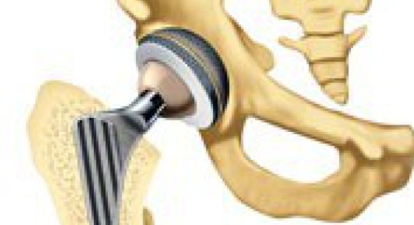 Hüftprothese - OA Dr. Lukas Karamat - Orthopäde Wien 1030