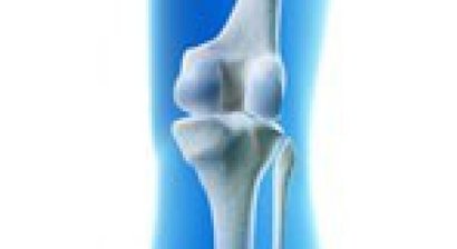 Knieprothese