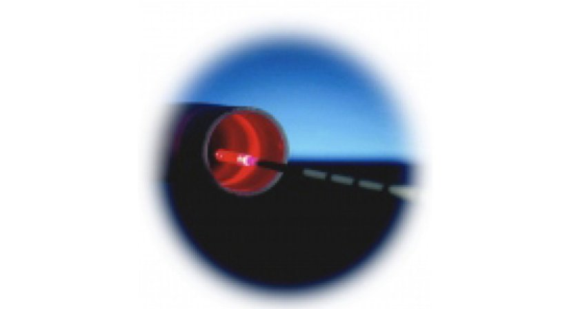 Venenbehandlung: Endovenöse Laserbehandlung - OA Dr. Niklas Spitzer - Allgemeinchirurg St. Pölten 3100