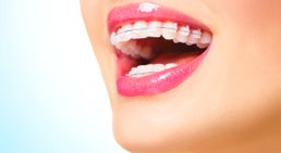 Brackets -