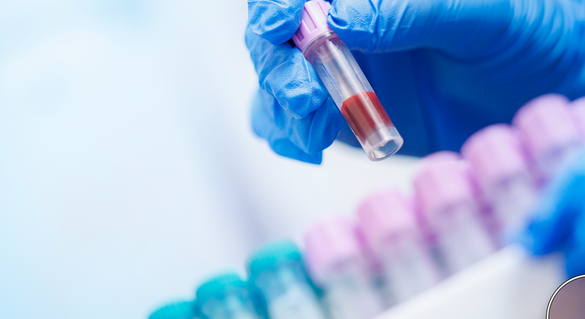 Eigenblut Therapie (PRP) - Priv. Doz. Dr. Florian M. Kovar - Orthopäde Wien 1010