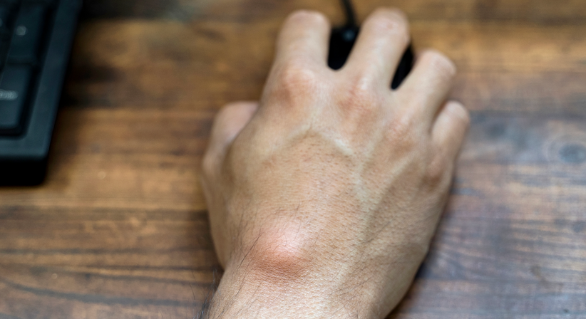 Erkrankungen der Hand (Rhizarthrose / Ganglion) - Priv. Doz. Dr. Florian M. Kovar - Orthopäde Wien 1010