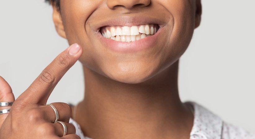 Professionelle Mundhygiene /Zahnprophylaxe - Dr. Clemens Ganger - Zahnarzt Wien 1140