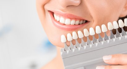 Zahnkronen und Zahnbrücken