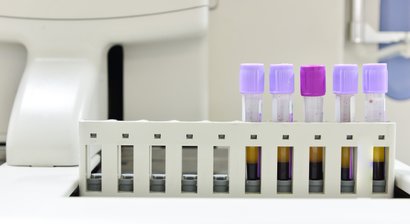 Eigenblutbehandlung (PRP/ACP-Therapie)