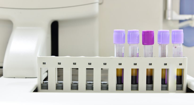 Eigenblutbehandlung (PRP/ACP-Therapie) - Dr. Philippe Reuter, MSc - Orthopäde Brunn am Gebirge 2345