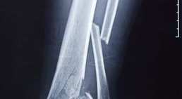 Dr. Philippe Reuter, MSc - Orthopäde Brunn am Gebirge 2345