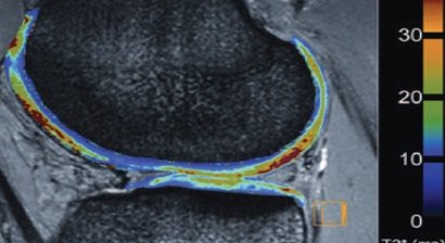 Behandlung von Knieverletzungen