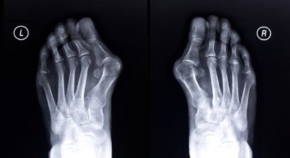 Fuß- und Handchirurgie