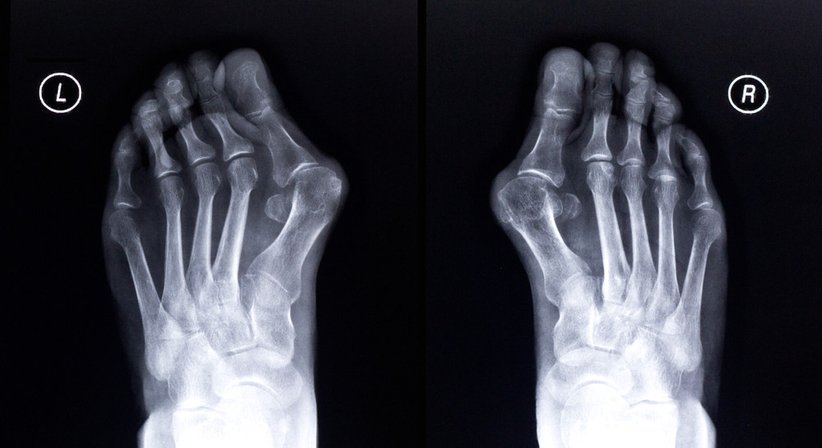 Fuß- und Handchirurgie - Prof.Priv.-Doz.OA.Dr. Harald K. Widhalm, MBA - Unfallchirurg Wien 1010