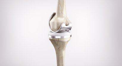 Gelenkersatzoperationen