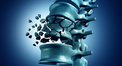 Wirbelsäulenbehandlungen