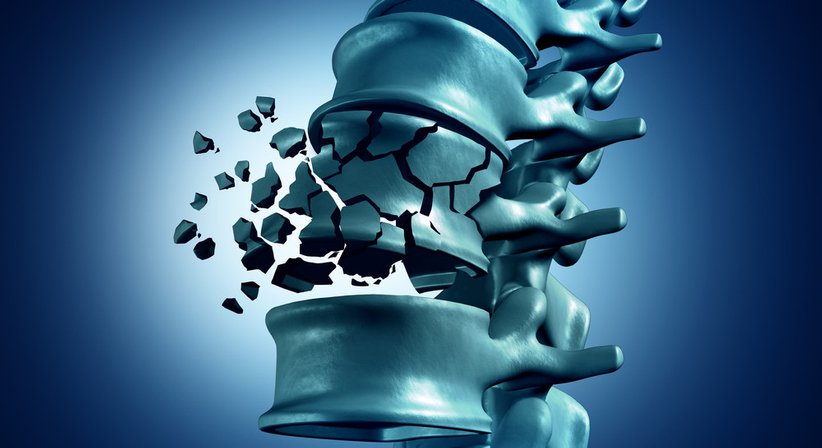 Wirbelsäulenbehandlungen - Prof.Priv.-Doz.OA.Dr.  Harald K. Widhalm, MBA - Unfallchirurg Wien 1010