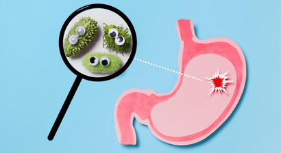 Abklärung von Magenschmerzen