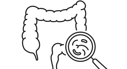 Abklärung von Durchfällen