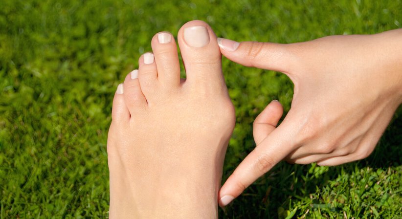 Hallux valgus - Priv.-Doz.DDr. Alexander Aichmair, MPH - Orthopäde Gols 7122