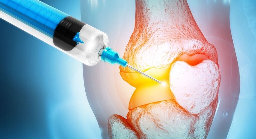 Infiltration bei Dr. Michael Ostermann